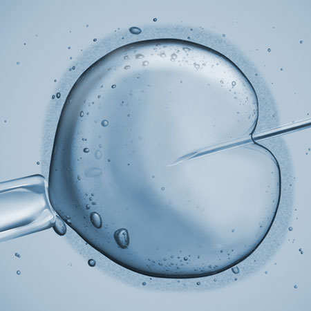 IVF ICSE Treatment in Kanhangad