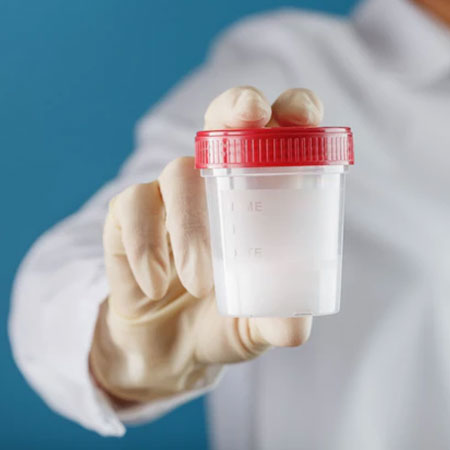 Semen Analysis in Kanhangad